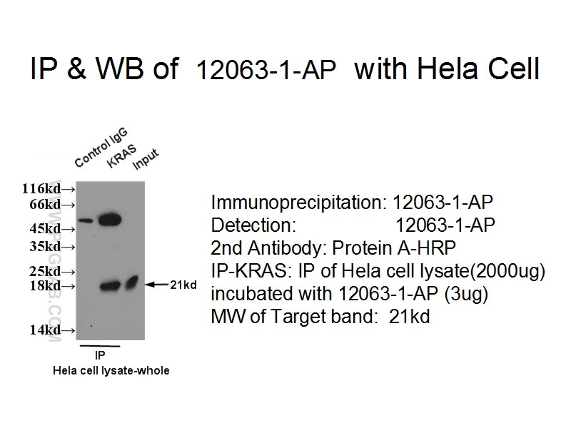 OCT4 IP 11263-1-AP OCT4 Antibody MGC22487; OCT3; OCT4; OTF3; OTF4