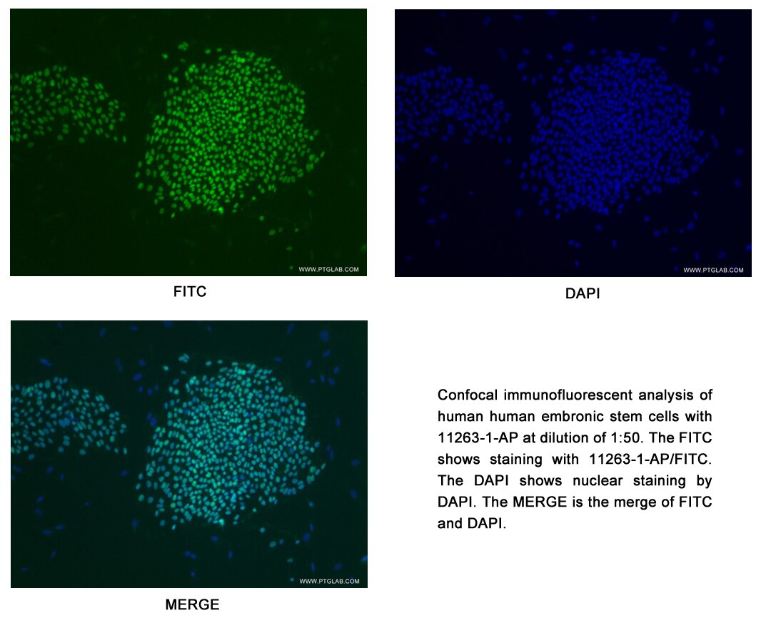 http://www.ptglab.com/Products/Pictures/OCT4-Antibody-11263-1-AP-A4IF.jpg