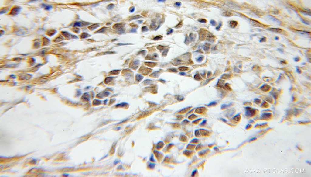 OCT4 IHC Immunohistochemical 11263-1-AP OCT4 Antibody MGC22487; OCT3; OCT4; OTF3; OTF4