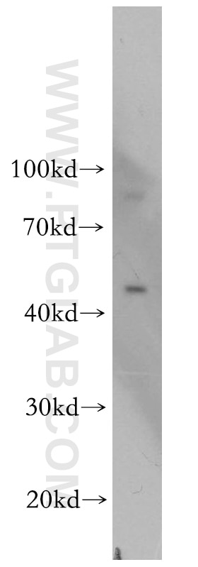 OCT4 western blot WB 11263-1-AP OCT4 Antibody MGC22487; OCT3; OCT4; OTF3; OTF4