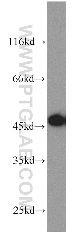 Jurkat cells were subjected to SDS PAGE followed by western blot with 13130-1-AP(ORAI1 Antibody) at dilution of 1:800 ORAI1 western blot WB 13130-1-AP ORAI1 Antibody CRACM1; FLJ14466; ORAT1; TMEM142A