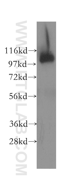 Y79 cells were subjected to SDS PAGE followed by western blot with 12417-1-AP(OSBPL3 Antibody) at dilution of 1:800 OSBPL3 western blot WB 12417-1-AP OSBPL3 Antibody DKFZp667P1518; KIAA0704; MGC21526; ORP-3; ORP3; OSBP3