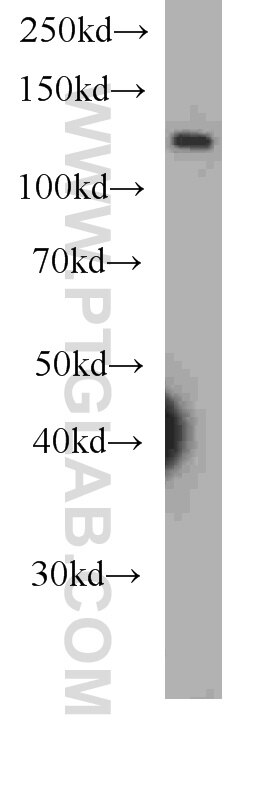 OSMR western blot WB 60071-1-Ig OSMR Antibody MGC150626; MGC150627; MGC75127; OSMRB