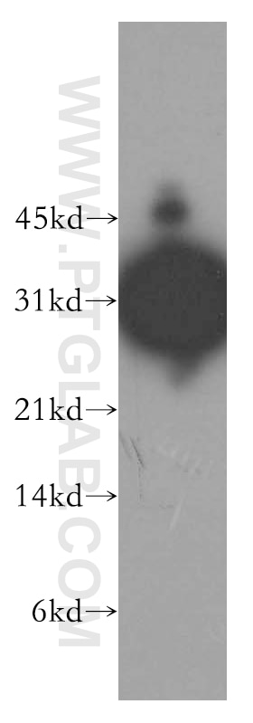 OTX2 western blot WB 13497-1-AP OTX2 Antibody MCOPS5; MGC45000