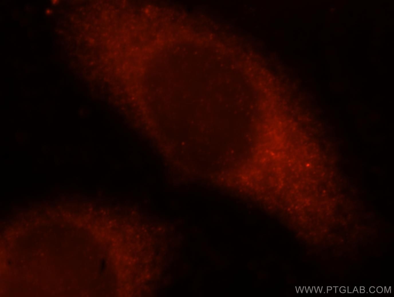 OXSR1 Immunofluorescence IF 15611-1-AP OXSR1 Antibody KIAA1101; OSR1
