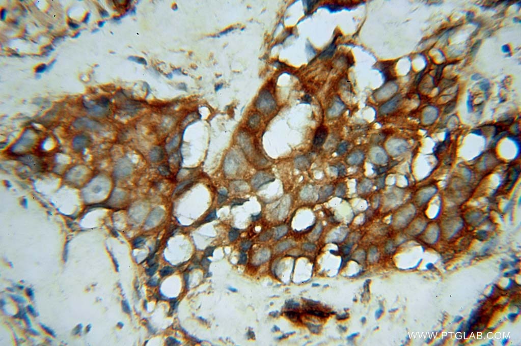 OXSR1 IHC Immunohistochemical 15611-1-AP OXSR1 Antibody KIAA1101; OSR1