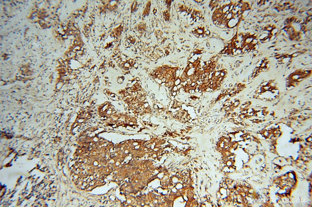 OXSR1 IHC Immunohistochemical 15611-1-AP OXSR1 Antibody KIAA1101; OSR1