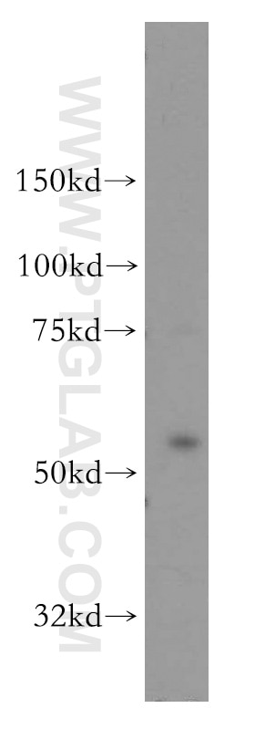 OXSR1 western blot WB 15611-1-AP OXSR1 Antibody KIAA1101; OSR1