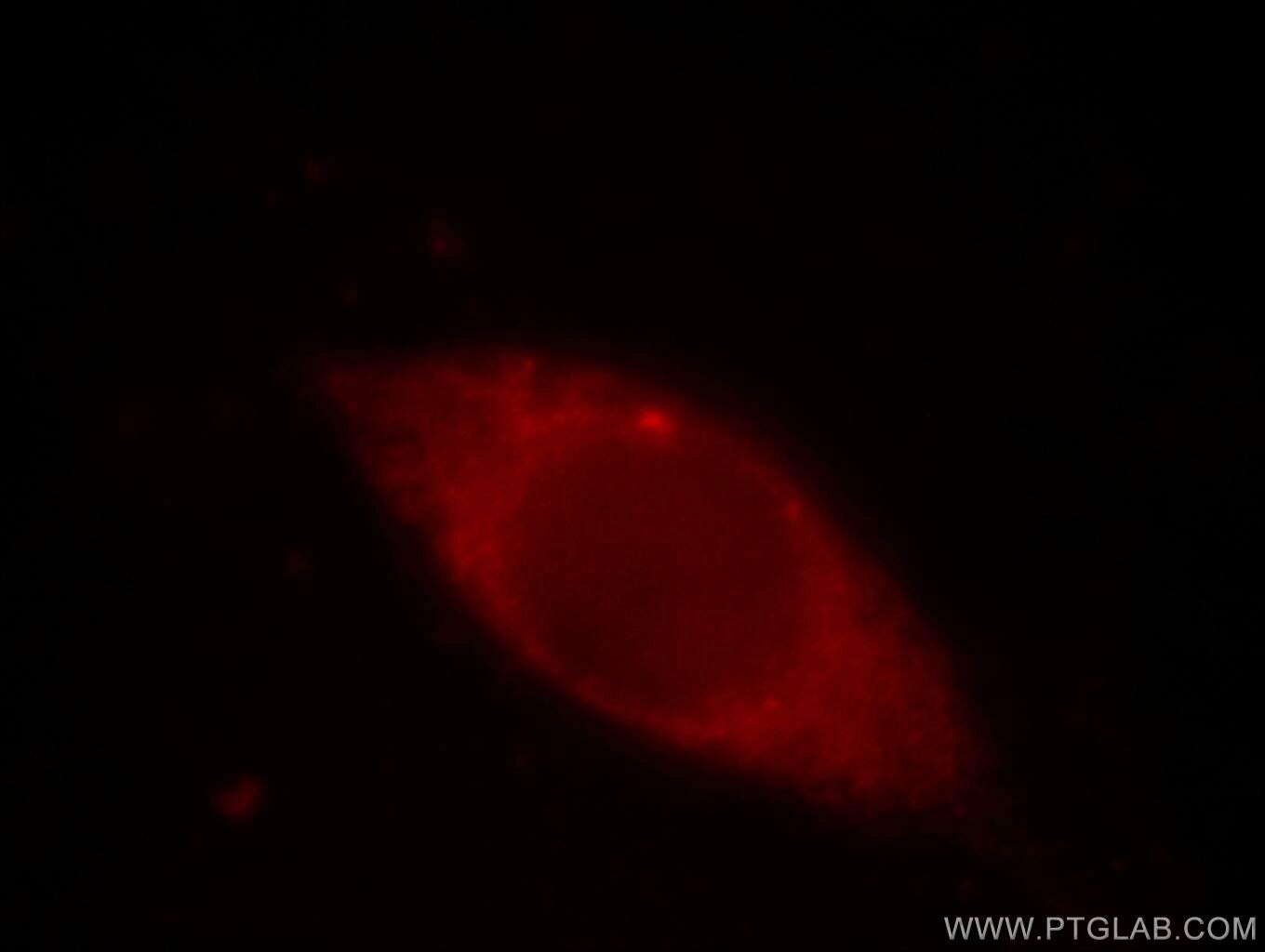 Immunofluorescent analysis of MCF-7 cells, using CDKN1A antibody 60214-1-lg at 1:50 dilution and Rhodamine-labeled goat anti-mouse IgG (red). P21 Immunofluorescence IF 60214-1-Ig P21 Antibody CAP20; CDKN1; CIP1; MDA-6; P21; SDI1; WAF1; p21CIP1