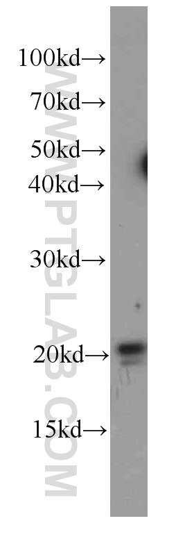 293 cells were subjected to SDS PAGE followed by western blot with 60214-1-Ig(P21 Antibody) at dilution of 1:1000 P21 western blot WB 60214-1-Ig P21 Antibody CAP20; CDKN1; CIP1; MDA-6; P21; SDI1; WAF1; p21CIP1