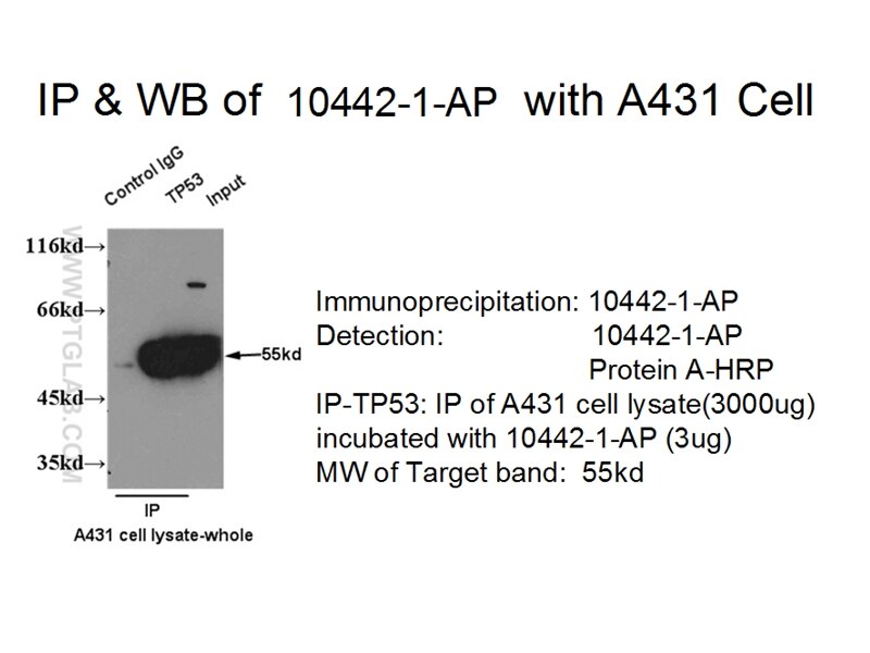 P53 IP 10442-1-AP P53 Antibody FLJ92943; LFS1; TRP53; p53
