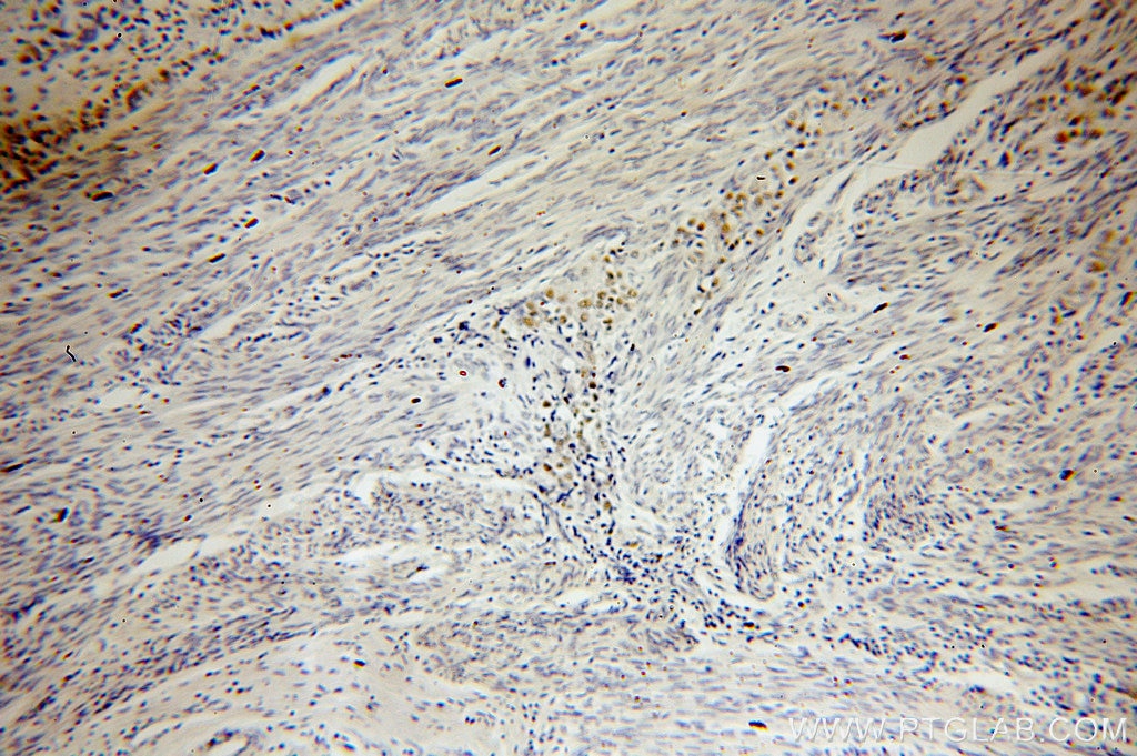 P53 IHC Immunohistochemical 10442-1-AP P53 Antibody FLJ92943; LFS1; TRP53; p53