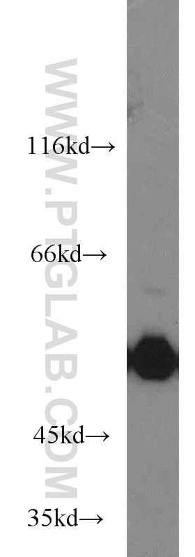 P53 western blot WB 10442-1-AP P53 Antibody FLJ92943; LFS1; TRP53; p53