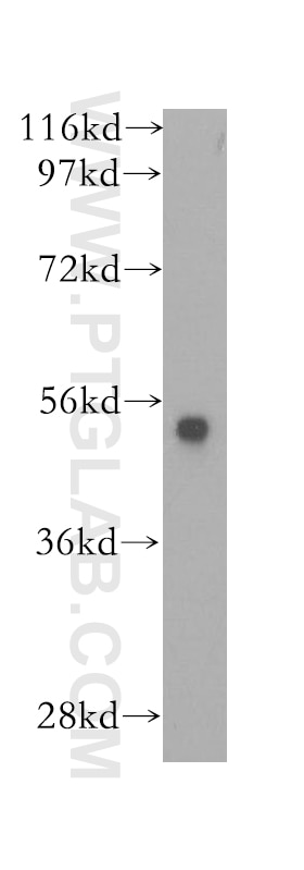 BxPC-3 cells were subjected to SDS PAGE followed by western blot with 12110-1-AP(PADI2 Antibody) at dilution of 1:1000 PADI2 western blot WB 12110-1-AP PADI2 Antibody KIAA0994; PAD-H19; PAD2; PDI2