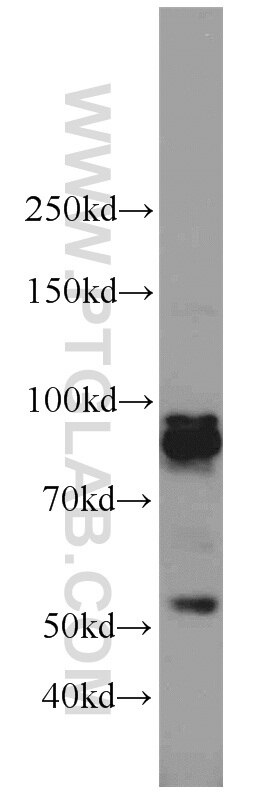 PALLD,palladin WB 10853-1-AP PALLD,palladin Antibody CGI-151; FLJ22190; FLJ38193; FLJ39139; KIAA0992; PNCA1; SIH002