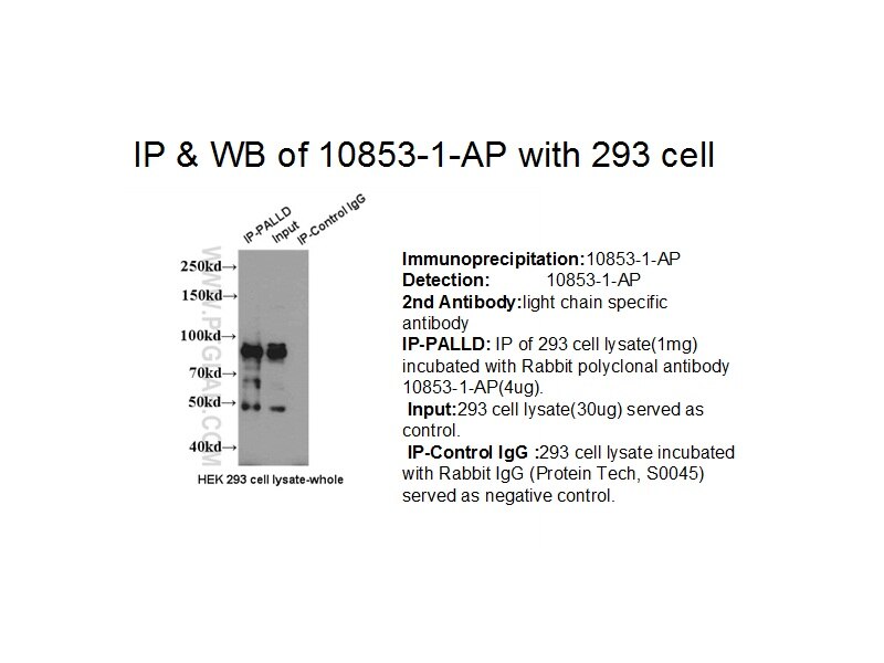 PALLD,palladin IP 10853-1-AP PALLD,palladin Antibody CGI-151; FLJ22190; FLJ38193; FLJ39139; KIAA0992; PNCA1; SIH002