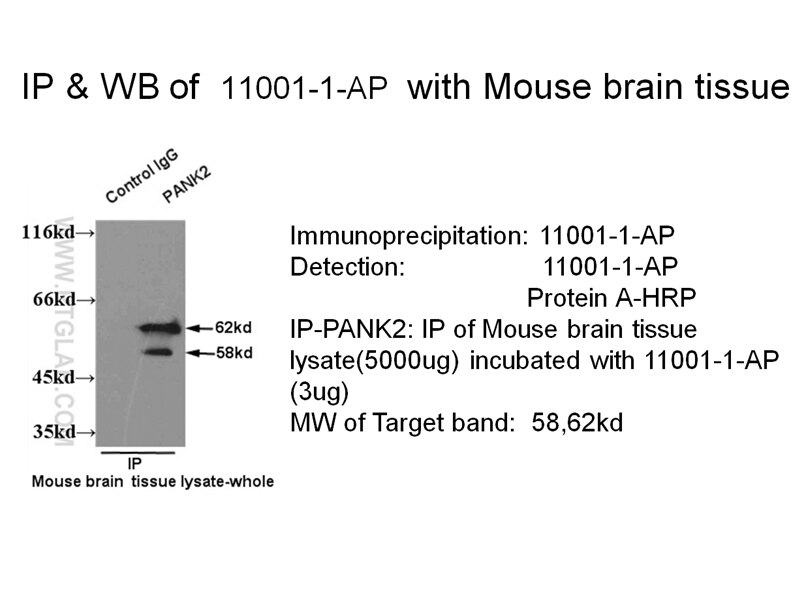 PANK2 IP 11001-1-AP PANK2 Antibody C20orf48; FLJ17232; HARP; HSS; MGC15053; NBIA1; PKAN