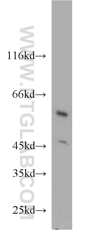 PANK2 western blot WB 11001-1-AP PANK2 Antibody C20orf48; FLJ17232; HARP; HSS; MGC15053; NBIA1; PKAN