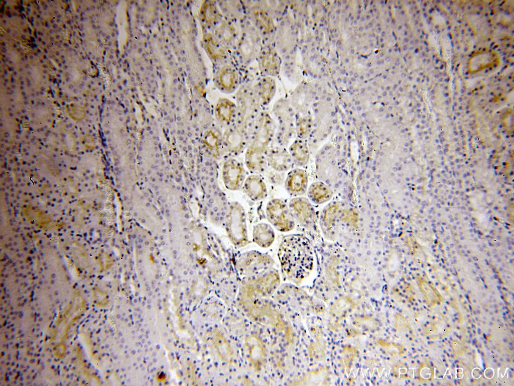 PCDGF,GRN IHC Immunohistochemical 18410-1-AP PCDGF,GRN Antibody GRN;GEP;GP88;PCDGF;PEPI;PGRN ;