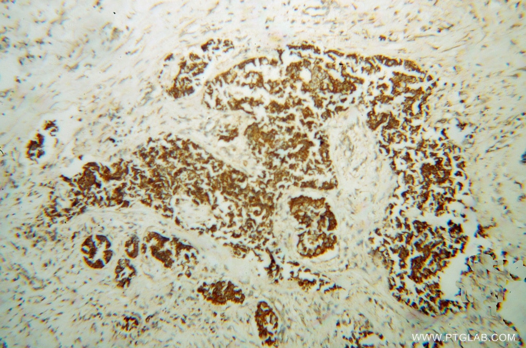 PCK2 IHC Immunohistochemical 14892-1-AP PCK2 Antibody PEPCK; PEPCK-M; PEPCK2