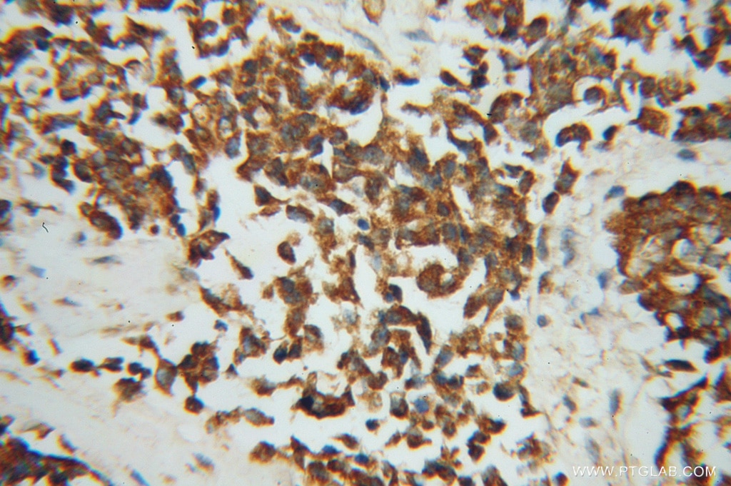 PCK2 IHC Immunohistochemical 14892-1-AP PCK2 Antibody PEPCK; PEPCK-M; PEPCK2