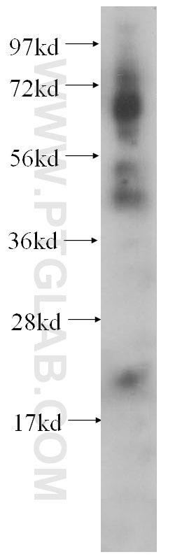 PCK2 western blot WB 14892-1-AP PCK2 Antibody PEPCK; PEPCK-M; PEPCK2