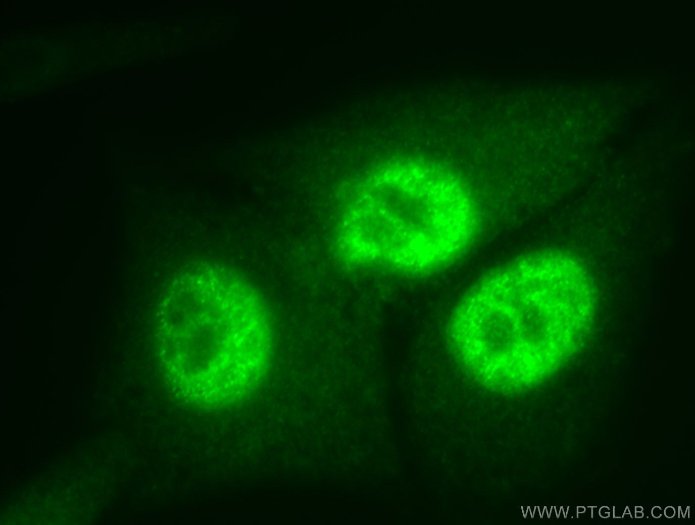 Immunofluorescent analysis of HepG2 cells, using PCNA antibody 10205-2-AP at 1:50 dilution and FITC-labeled donkey anti-rabbit IgG (green). PCNA Immunofluorescence IF 10205-2-AP PCNA Antibody MGC8367