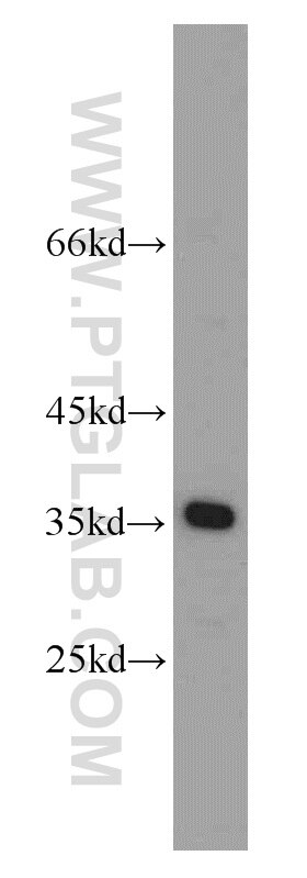 MCF7 cells were subjected to SDS PAGE followed by western blot with PCNA Antibody 10205-2-AP PCNA western blot WB 10205-2-AP PCNA Antibody MGC8367