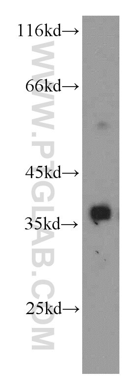 A431 cells were subjected to SDS PAGE followed by western blot with PCNA Antibody 10205-2-AP PCNA western blot WB 10205-2-AP PCNA Antibody MGC8367
