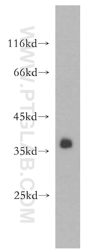 A431 cells were subjected to SDS PAGE followed by western blot with PCNA Antibody 10205-2-AP PCNA western blot WB 10205-2-AP PCNA Antibody MGC8367