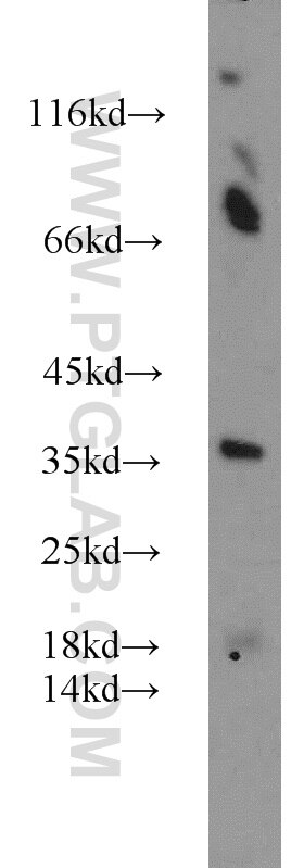 mouse testis tissue were subjected to SDS PAGE followed by western blot with PCNA Antibody 10205-2-AP PCNA western blot WB 10205-2-AP PCNA Antibody MGC8367