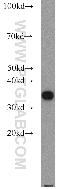 NIH/3T3 cells were subjected to SDS PAGE followed by western blot with PCNA Antibody 10205-2-AP PCNA western blot WB 10205-2-AP PCNA Antibody MGC8367