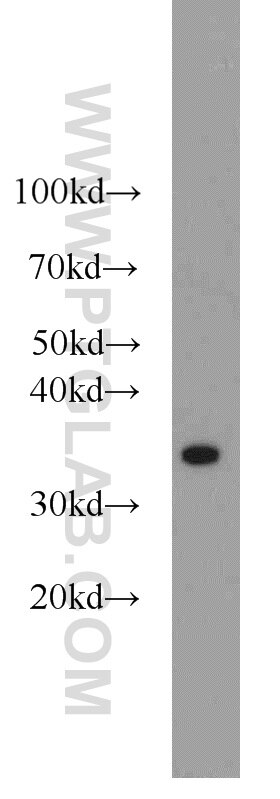 MCF7 cells were subjected to SDS PAGE followed by western blot with PCNA Antibody 10205-2-AP PCNA western blot WB 10205-2-AP PCNA Antibody MGC8367