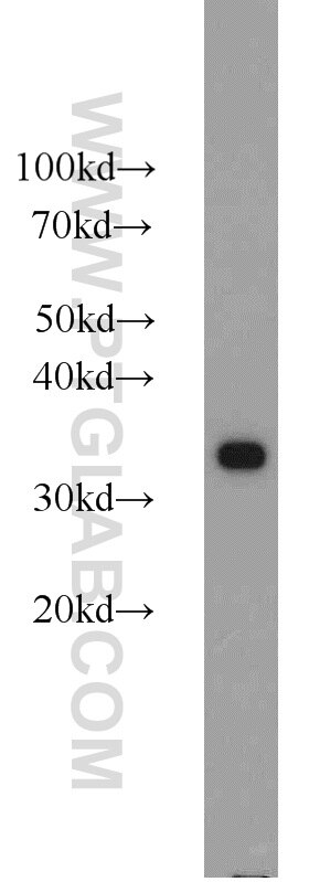 Jurkat cells were subjected to SDS PAGE followed by western blot with PCNA Antibody 10205-2-AP PCNA western blot WB 10205-2-AP PCNA Antibody MGC8367