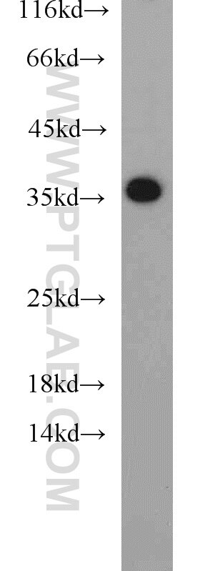 Jurkat cells were subjected to SDS PAGE followed by western blot with PCNA Antibody 10205-2-AP PCNA western blot WB 10205-2-AP PCNA Antibody MGC8367