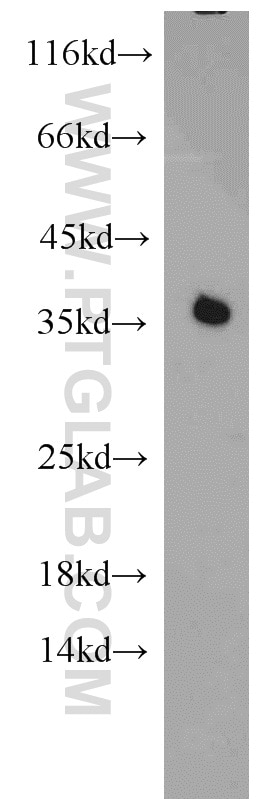 HepG2 cells were subjected to SDS PAGE followed by western blot with PCNA Antibody 10205-2-AP PCNA western blot WB 10205-2-AP PCNA Antibody MGC8367