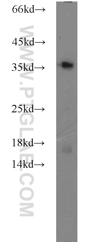 Jurkat cells were subjected to SDS PAGE followed by western blot with PCNA Antibody 10205-2-AP PCNA western blot WB 10205-2-AP PCNA Antibody MGC8367