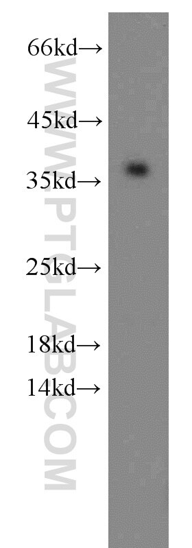 HepG2 cells were subjected to SDS PAGE followed by western blot with PCNA Antibody 10205-2-AP PCNA western blot WB 10205-2-AP PCNA Antibody MGC8367