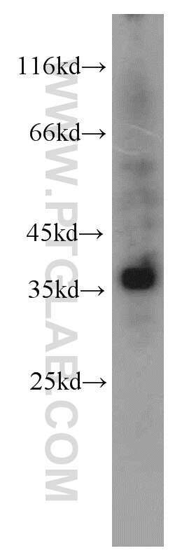 Raji cells were subjected to SDS PAGE followed by western blot with PCNA Antibody 10205-2-AP PCNA western blot WB 10205-2-AP PCNA Antibody MGC8367