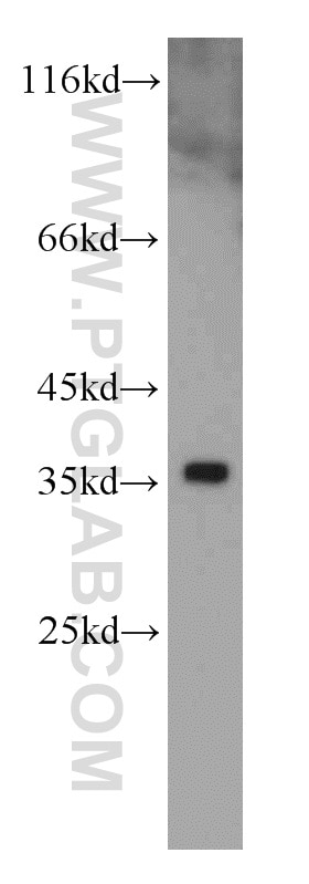 MCF7 cells were subjected to SDS PAGE followed by western blot with PCNA Antibody 10205-2-AP PCNA western blot WB 10205-2-AP PCNA Antibody MGC8367