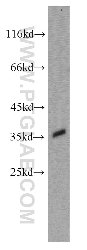 HEK-293 cells were subjected to SDS PAGE followed by western blot with PCNA Antibody 10205-2-AP PCNA western blot WB 10205-2-AP PCNA Antibody MGC8367