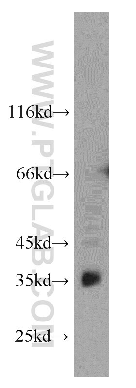 A431 cells were subjected to SDS PAGE followed by western blot with PCNA Antibody 10205-2-AP PCNA western blot WB 10205-2-AP PCNA Antibody MGC8367