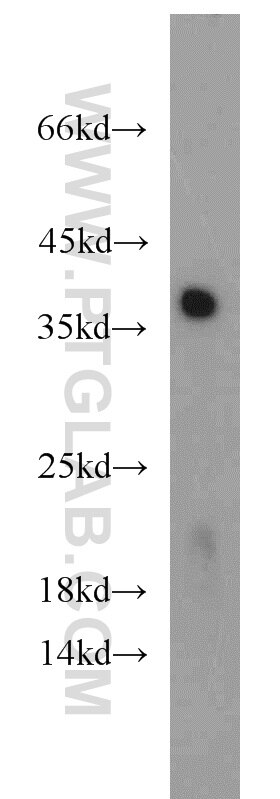Raji cells were subjected to SDS PAGE followed by western blot with PCNA Antibody 10205-2-AP PCNA western blot WB 10205-2-AP PCNA Antibody MGC8367