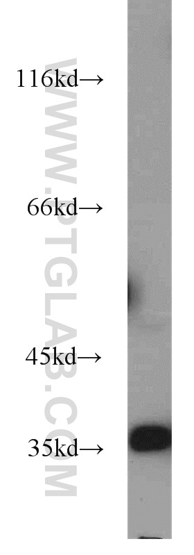 HEK-293 cells were subjected to SDS PAGE followed by western blot with PCNA Antibody 10205-2-AP PCNA western blot WB 10205-2-AP PCNA Antibody MGC8367