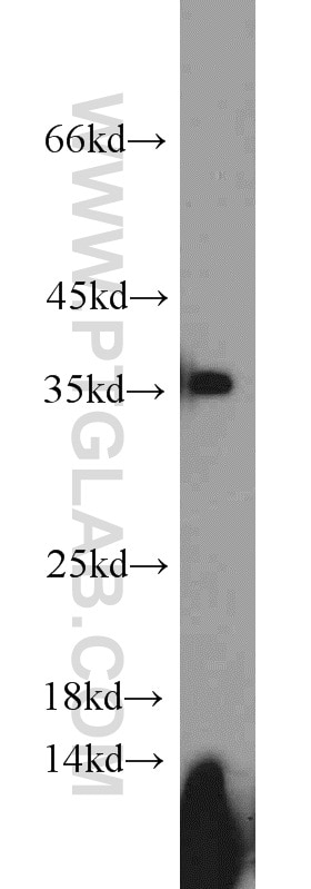 mouse testis tissue were subjected to SDS PAGE followed by western blot with PCNA Antibody 10205-2-AP PCNA western blot WB 10205-2-AP PCNA Antibody MGC8367