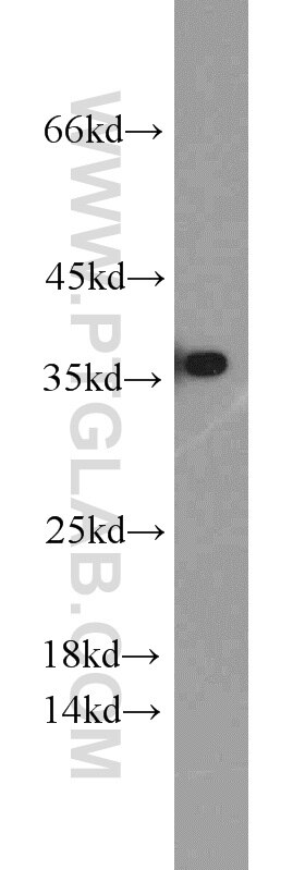 Raji cells were subjected to SDS PAGE followed by western blot with PCNA Antibody 10205-2-AP PCNA western blot WB 10205-2-AP PCNA Antibody MGC8367