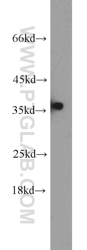 Jurkat cells were subjected to SDS PAGE followed by western blot with PCNA Antibody 10205-2-AP PCNA western blot WB 10205-2-AP PCNA Antibody MGC8367