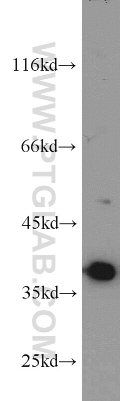 MCF7 cells were subjected to SDS PAGE followed by western blot with PCNA Antibody 10205-2-AP PCNA western blot WB 10205-2-AP PCNA Antibody MGC8367