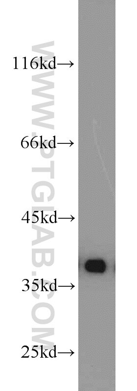 MCF7 cells were subjected to SDS PAGE followed by western blot with PCNA Antibody 10205-2-AP PCNA western blot WB 10205-2-AP PCNA Antibody MGC8367