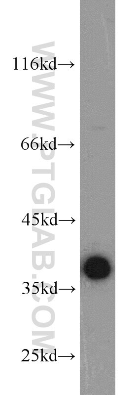 MCF7 cells were subjected to SDS PAGE followed by western blot with PCNA Antibody 10205-2-AP PCNA western blot WB 10205-2-AP PCNA Antibody MGC8367